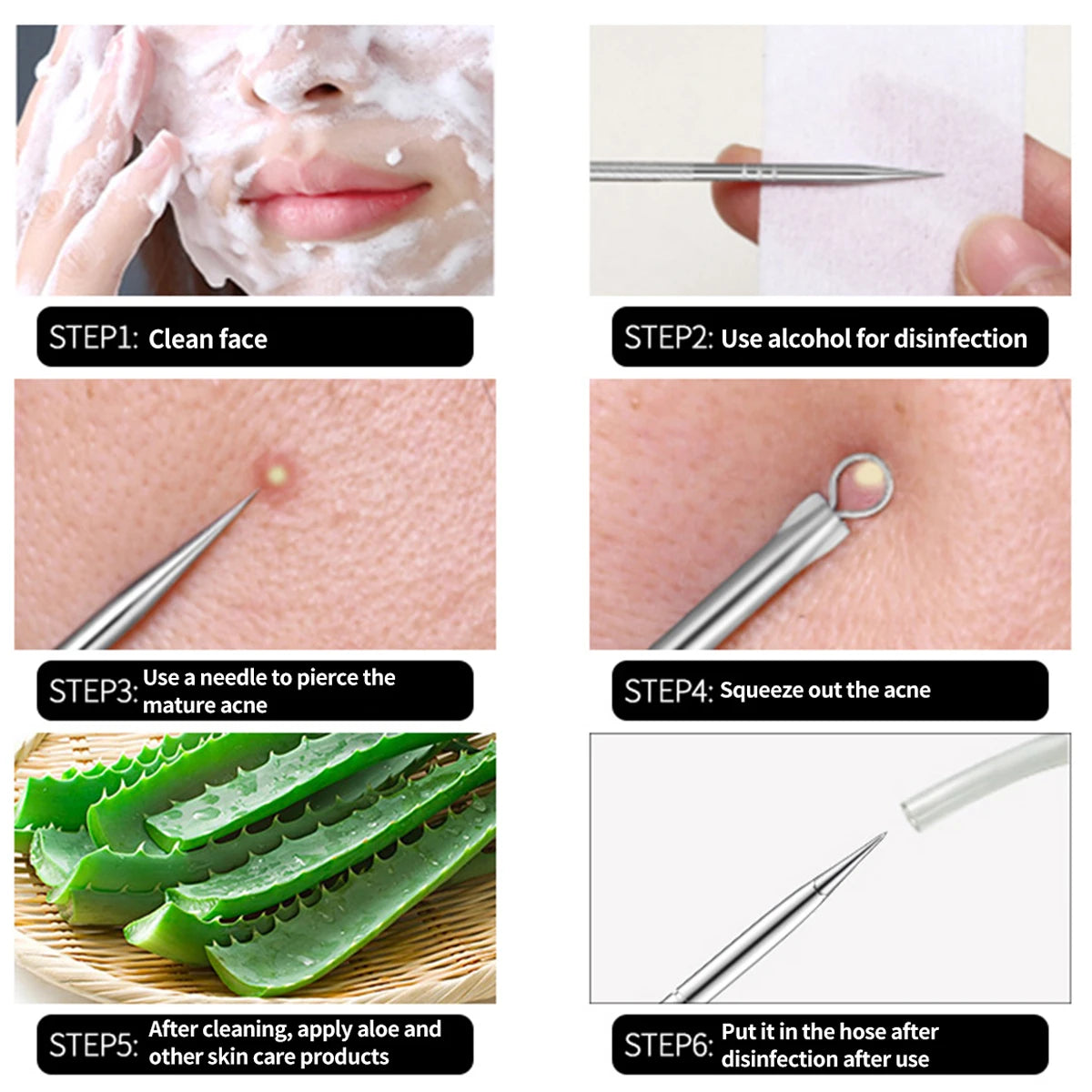 4PCS Acne Blackhead Comedone Black Spot Pimple Blemish Remover Skin Care Women Beauty Acne Treatment Pore Cleanser Needle Hook